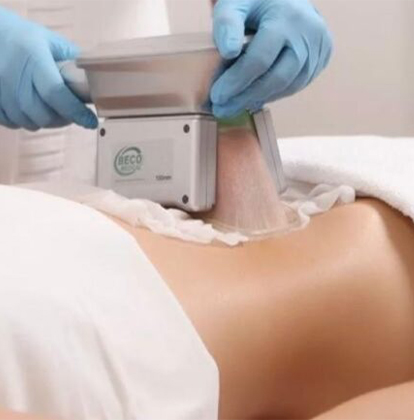 Cryolipolysis